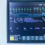 What Is Ambulatory Blood Pressure Monitoring?